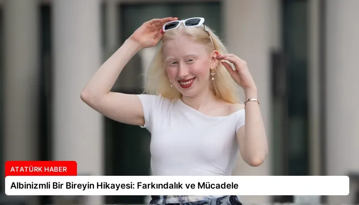 Albinizmli Bir Bireyin Hikayesi: Farkındalık ve Mücadele