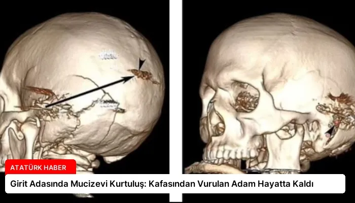 Girit Adasında Mucizevi Kurtuluş: Kafasından Vurulan Adam Hayatta Kaldı