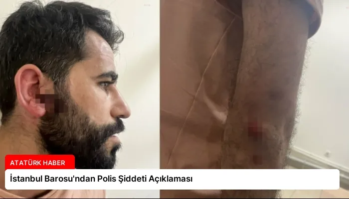 İstanbul Barosu’ndan Polis Şiddeti Açıklaması